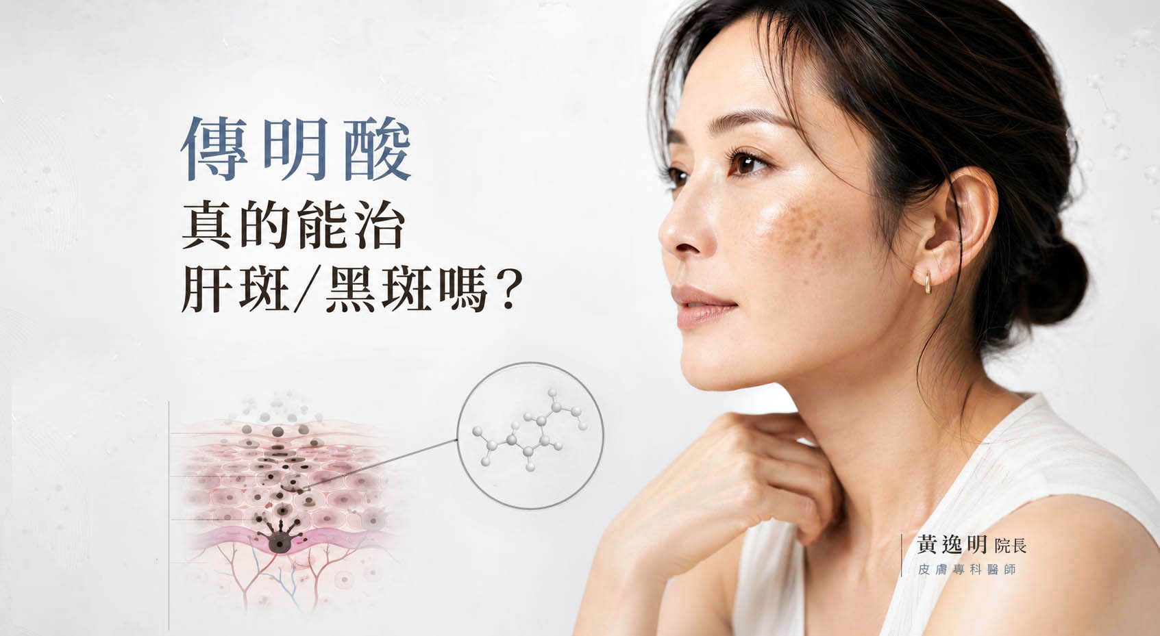 article-6277-thumbnail